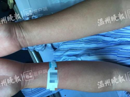 高烧39度照片,探寻身体与心灵的抗争